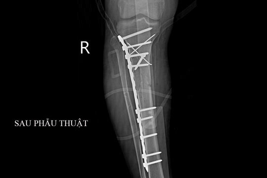  Tin tức - Sự kiện mới